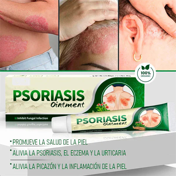 PSORIASIS?™ – Crema Calmante Antifúngica para Picazón y Resequedad | 20g