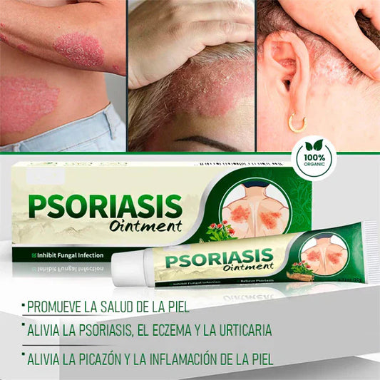 PSORIASIS?™ – Crema Calmante Antifúngica para Picazón y Resequedad | 20g