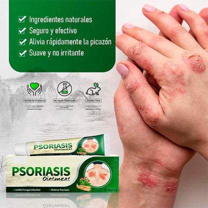 PSORIASIS?™ – Crema Calmante Antifúngica para Picazón y Resequedad | 20g
