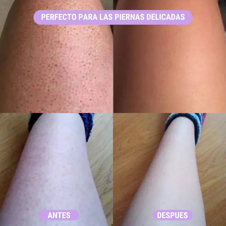 ⭐ DEBLAST™ 2x1 – Lleva 2 Depiladores Láser y Paga Solo 1