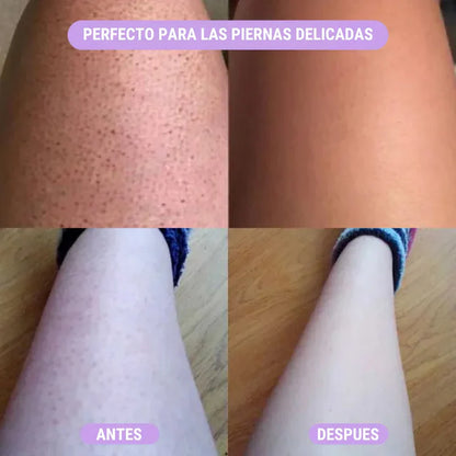 ⭐ DEBLAST™ 2x1 – Lleva 2 Depiladores Láser y Paga Solo 1